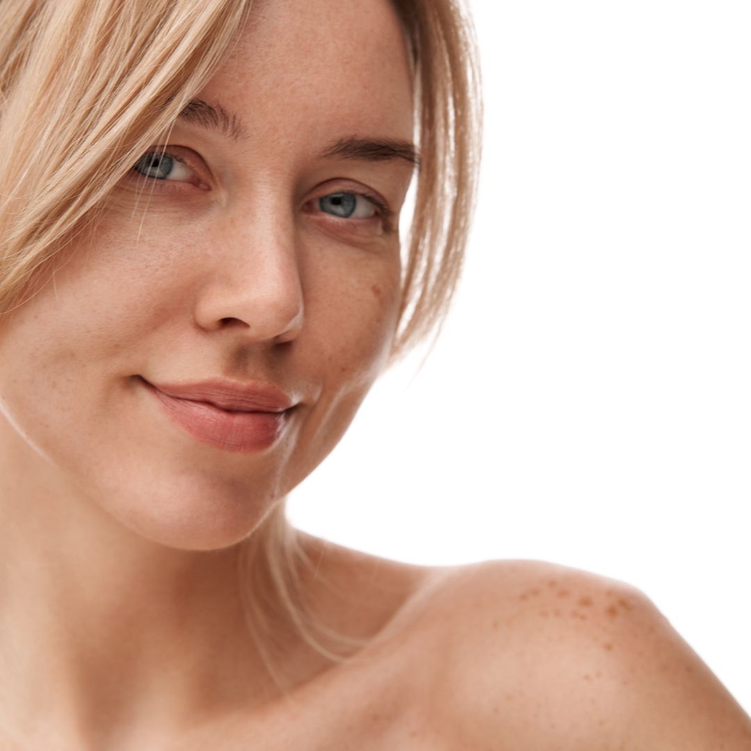 Moteris rodo pigmentuotą odą.