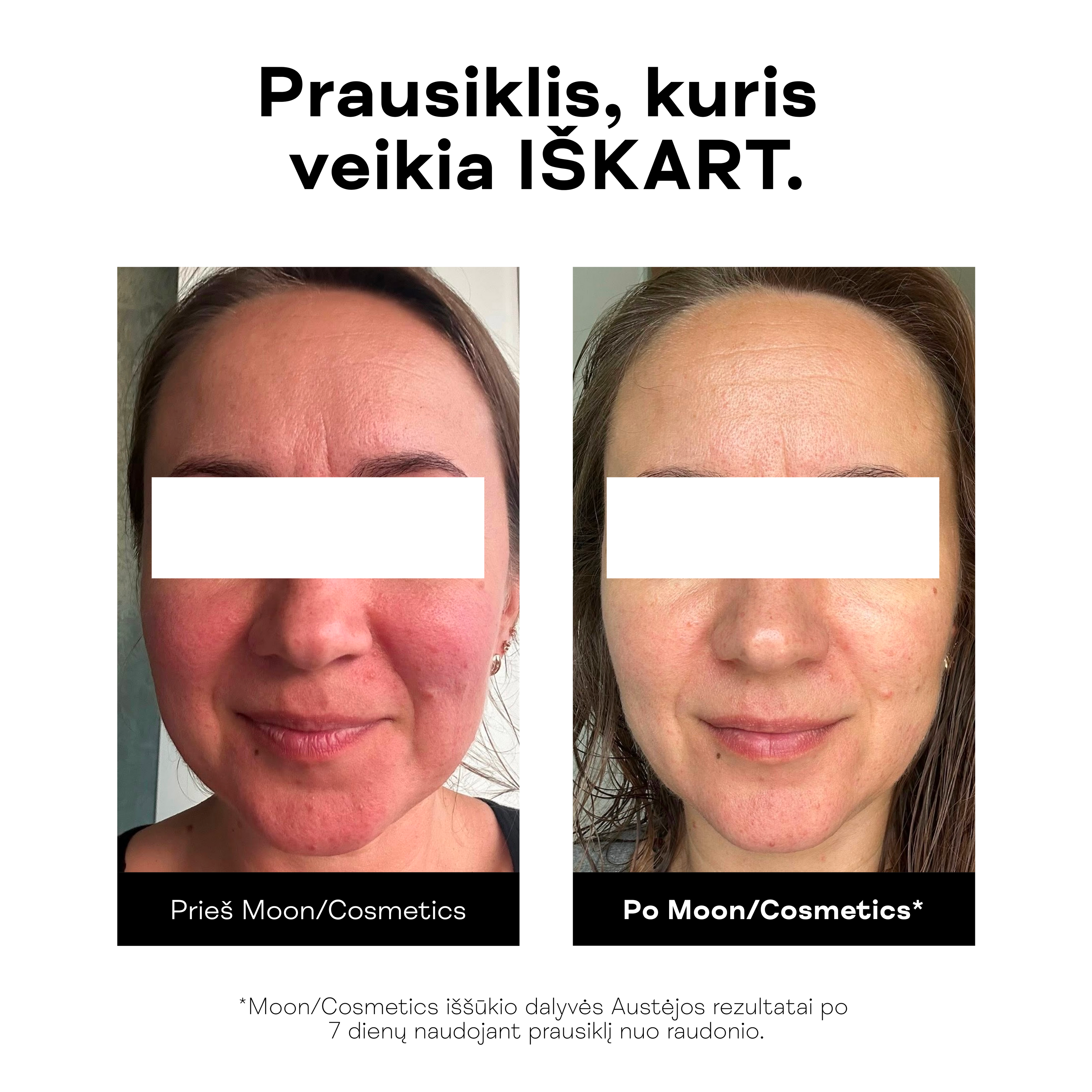Prausiklis nuo raudonio