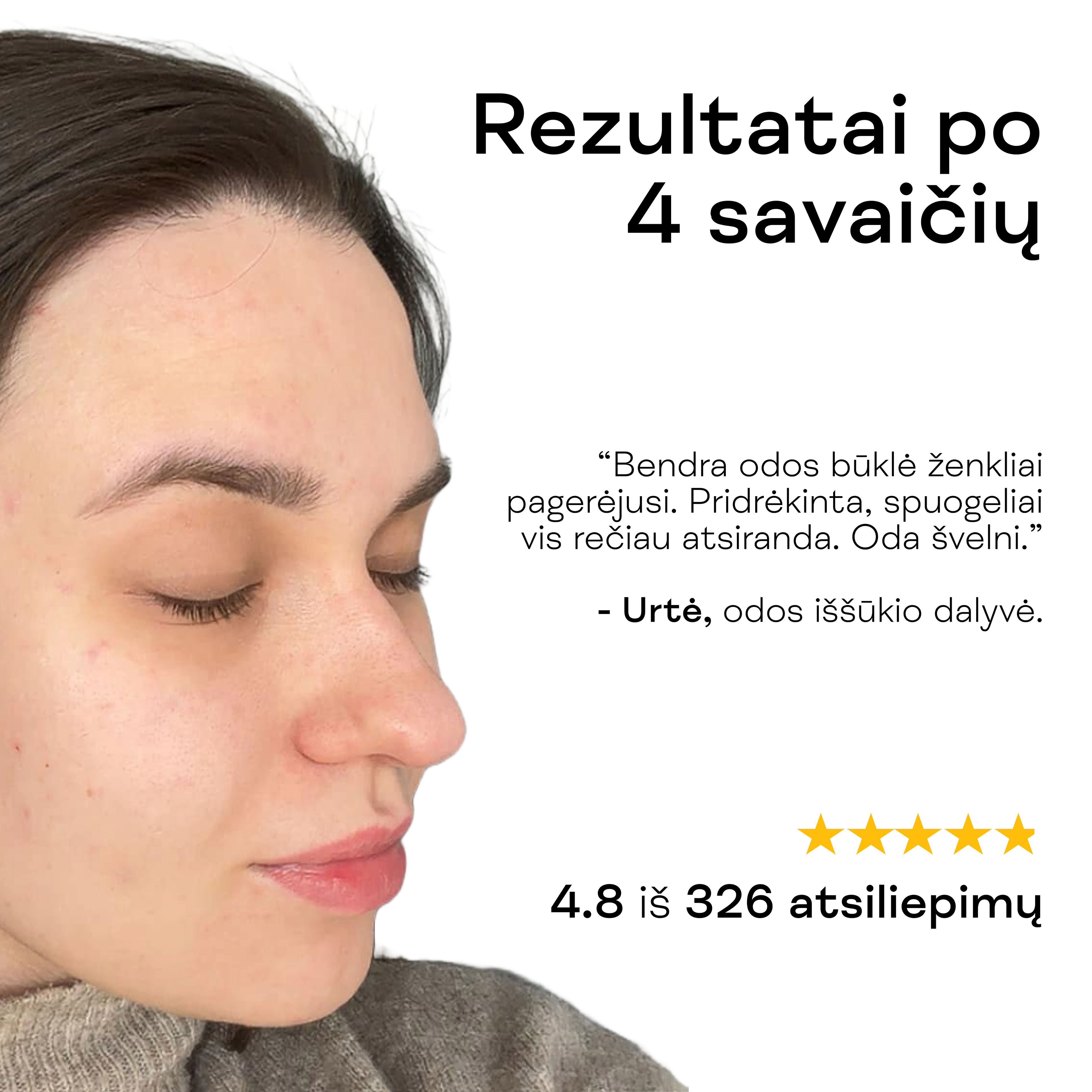 Moteris rodo skaistesnę, lygesnę odą po veido prausiklio nuo spuogų naudojimo.