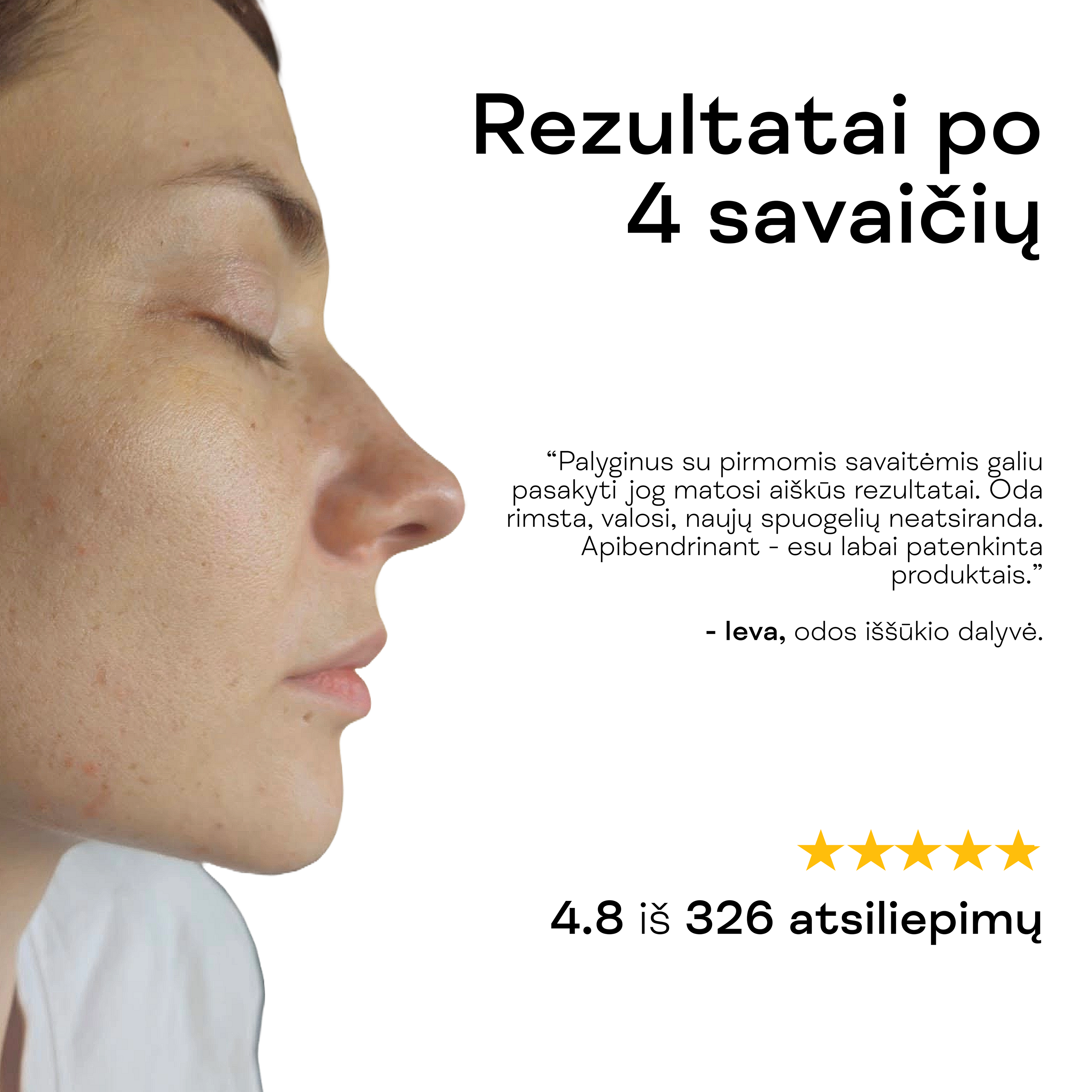 Moteris rodo ramesnę, skaistesnę odą po aktyvaus veido gelio nuo spuogų naudojimo.