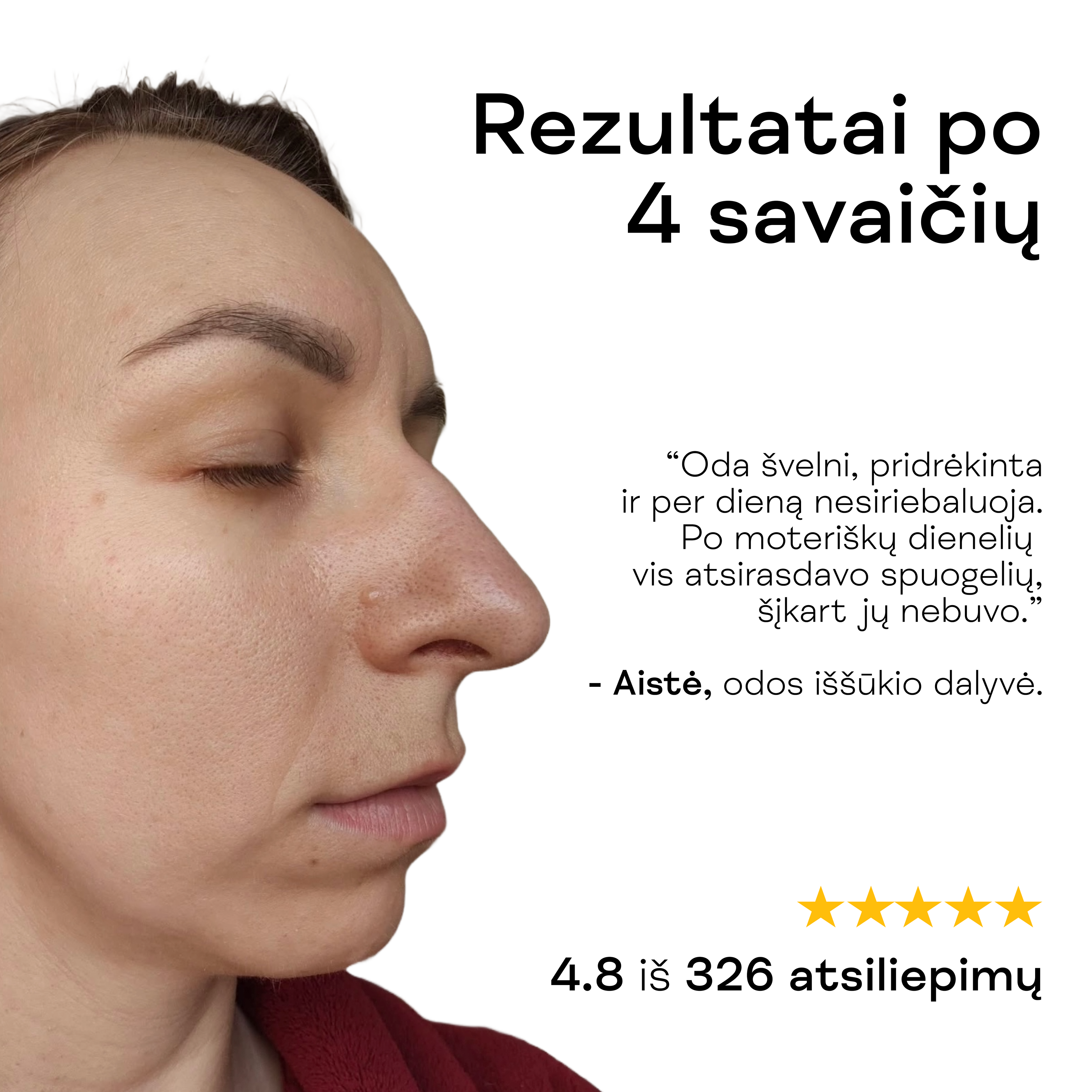 Moteris rodo švarią, skaistesnę odą be spuogų po veido toniko naudojimo.