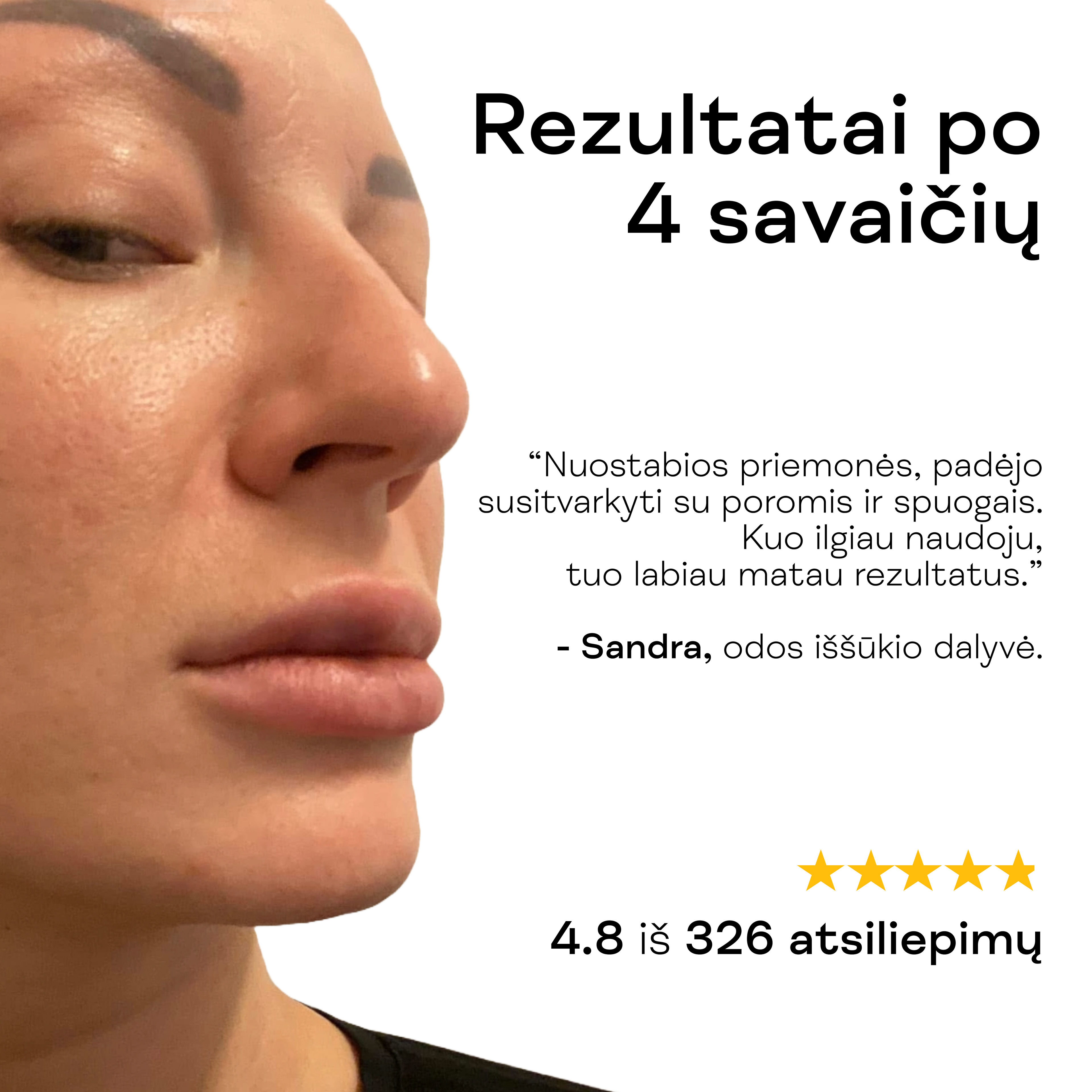 Moteris rodo sumažėjusias poras po Niacinamido serumo naudojimo.