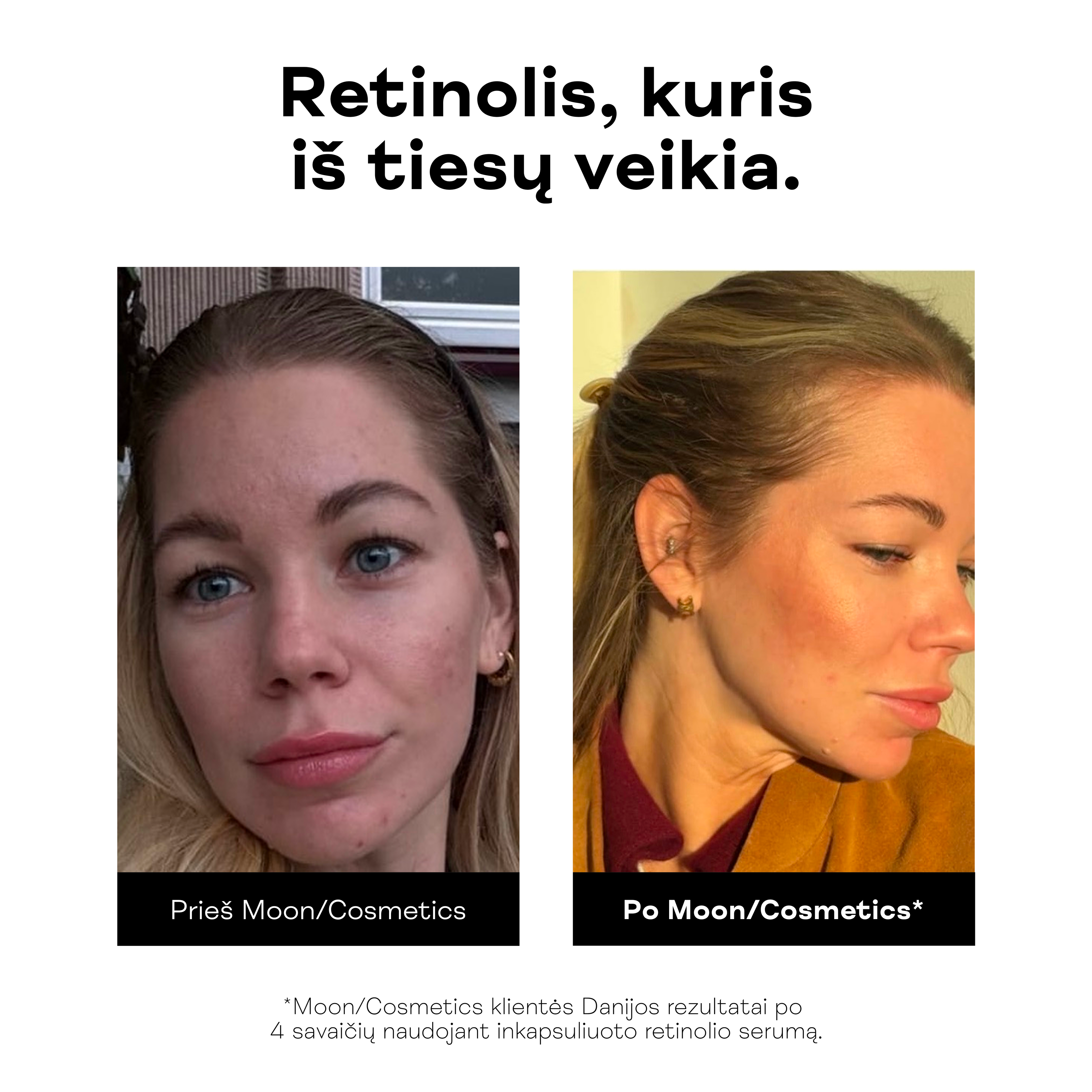Retinolio serumas