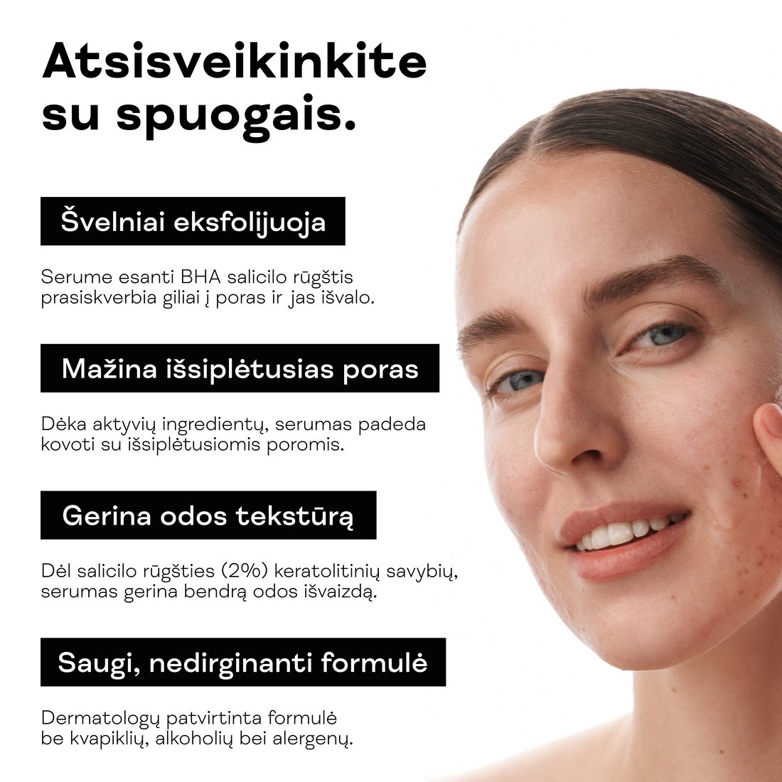 Moteris rodo veido odą su spuogais prieš Salicilo rūgšties serumo naudojimą.