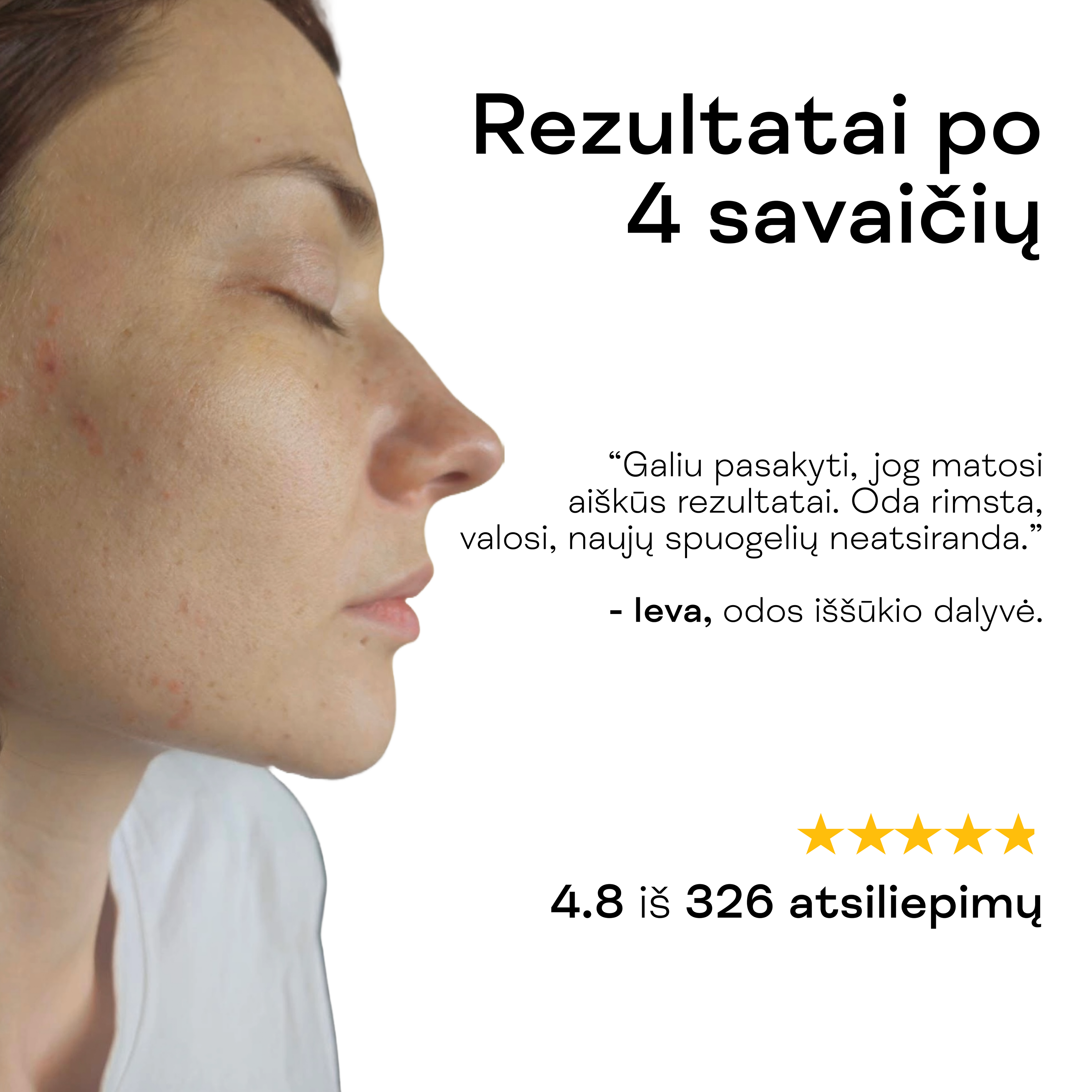 Moteris rodo ramesnę ir skaistesnę odą po salicilo rūgšties serumo nuo spuogų naudojimo.