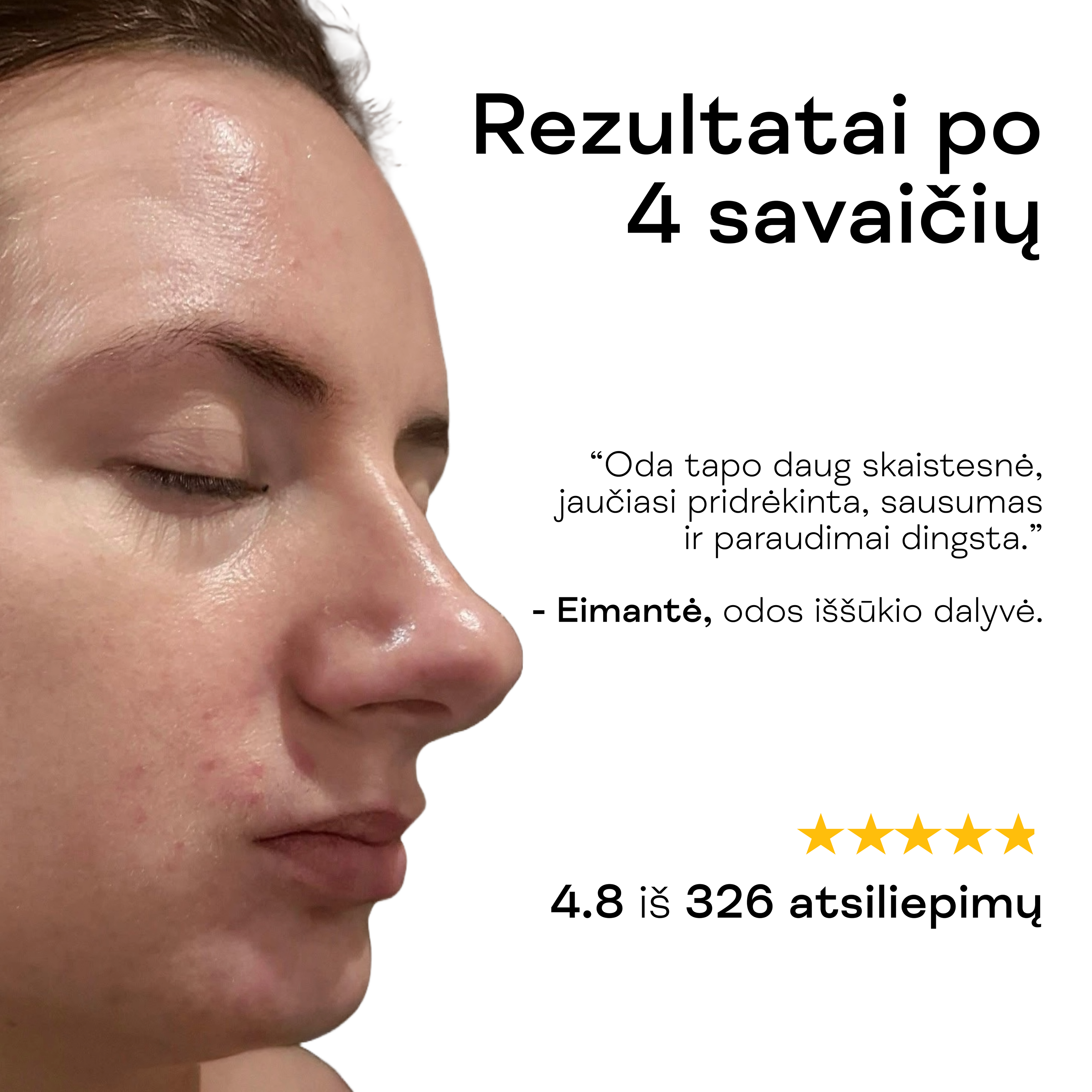 Moteris rodo skaistesnę, pridrėkintą odą po maitinamojo veido kremo su keramidais naudojimo.