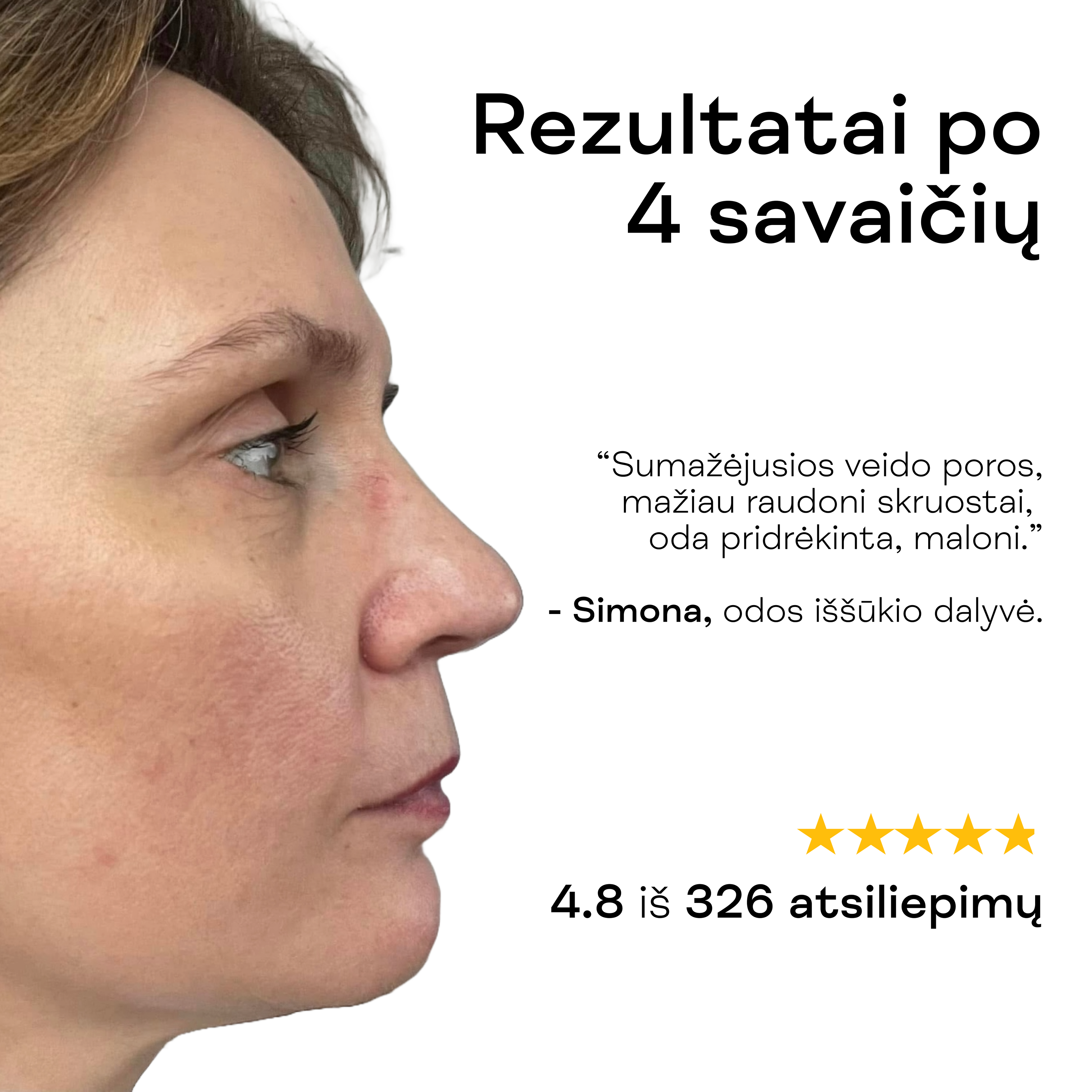 Moteris rodo lygesnę, ramesnę, drėkintą veido odą po hialurono rūgšties serumo naudojimo.
