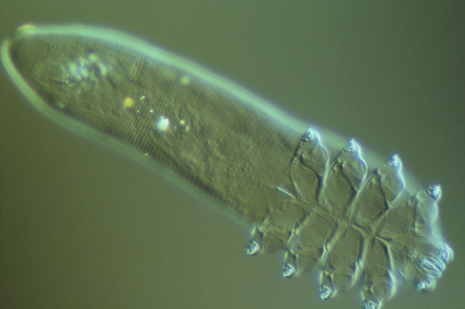 Demodex ir rožinė: mikroskopinių erkių įtaka odos būklei.