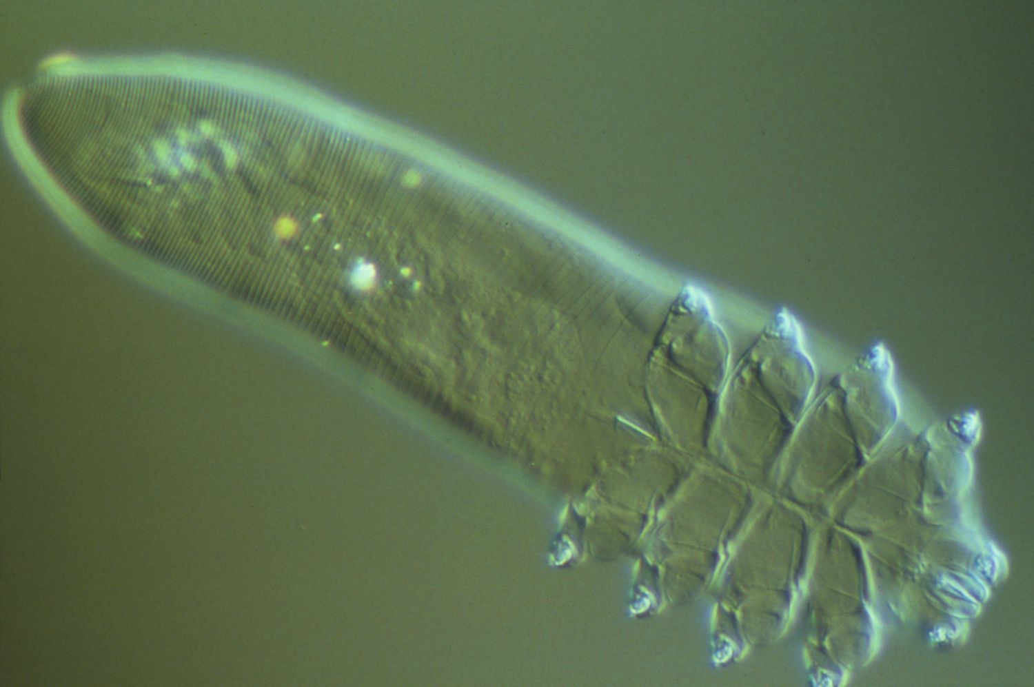 Demodex ir rožinė: mikroskopinių erkių įtaka odos būklei.