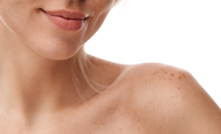 Kas yra odos pigmentacija?