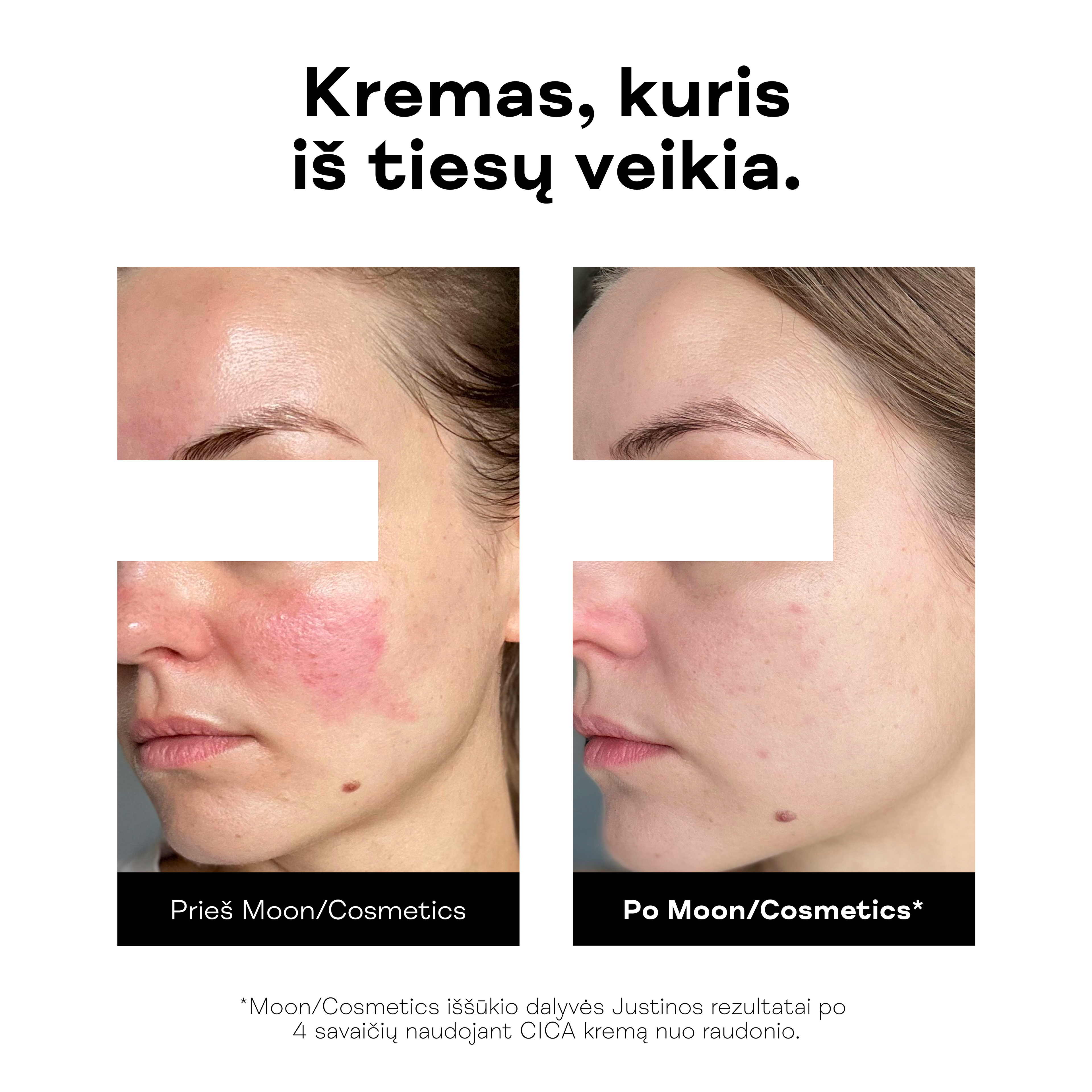 CICA-kremas-nuo-raudonio