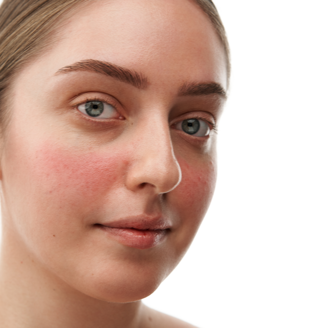 MINI rinkinys rožinės pažeistai odai