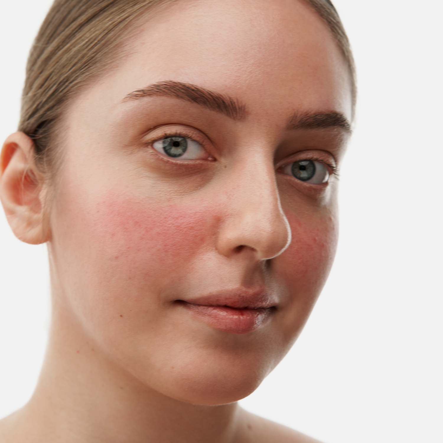 MINI rinkinys rožinės pažeistai odai